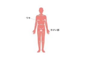 rinpamassa-jinotejyun